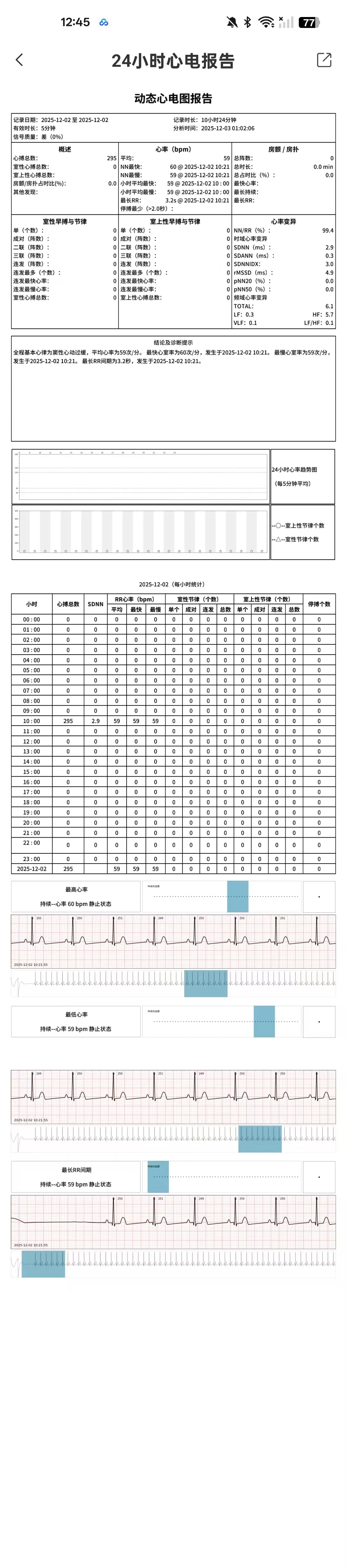 holter24小时动态心电监测完整心脏健康报告