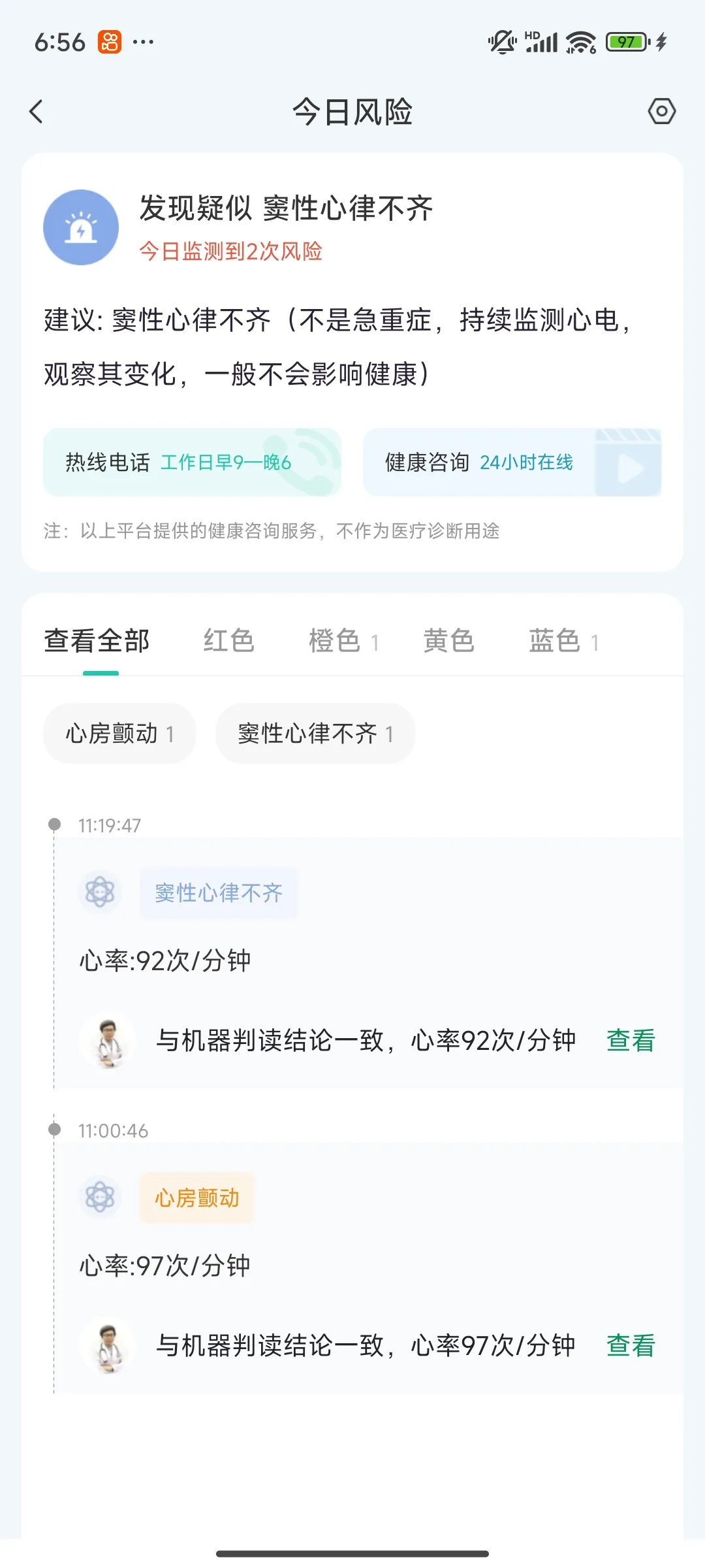 AI心电监护大模型风险预警30+心脏疾病筛查